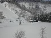 Lift 2 Top Chair - 2-persoons vaste stoeltjeslift