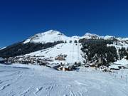 Uitzicht op Lech met Schlegelkopf