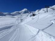 Feechatz - Sleeplift met T-beugel/Ankerlift