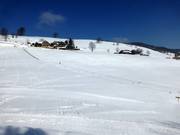 Kinderlift I - Sleeplift/babyllift