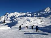 Makkelijke Riedkopf-omleiding